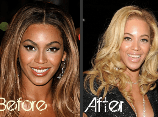 Celebrity Skin Lightening – Who’s Bleaching Their Skin? | The Health Base